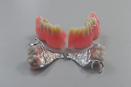 Reparaturen von Zahnprothesen